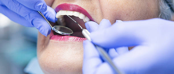 Best Emergency Wisdom Tooth Extraction in Highland Beach, FL